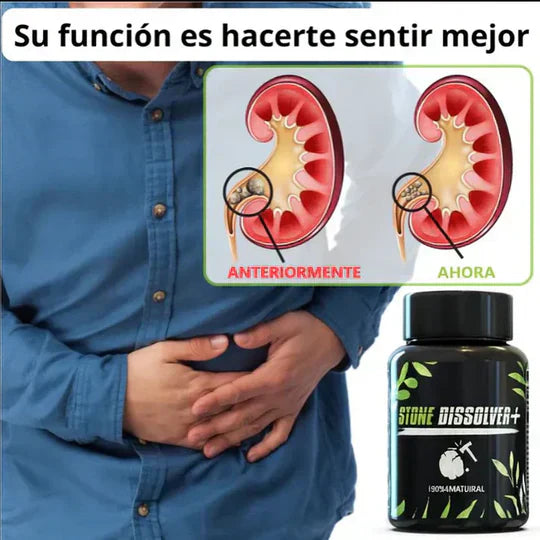 STONE DISSOLVER™ - Disuelve Cálculos, Alivia Dolor y Mejora el Flujo Urinario +ENVIO GRATIS