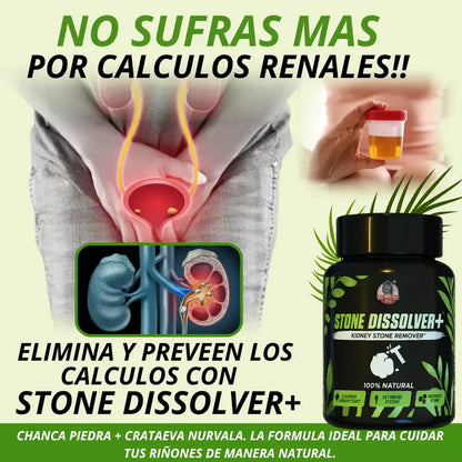 STONE DISSOLVER™ - Disuelve Cálculos, Alivia Dolor y Mejora el Flujo Urinario +ENVIO GRATIS