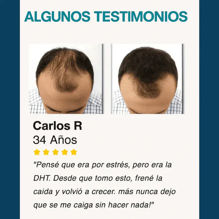 DHT BLOCKER X60: FORTALECE TU CABELLO DESDE LA RAÍZ 2x1