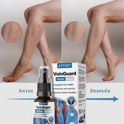 🩺 Varicose Veins™ Pro Tratamiento Intensivo Avanzado para Venas, Varices y Piernas Cansadas