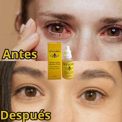 OFTALMIEL🐝Vuelve a sentir tus ojos frescos, hidratados y libres de molestias.
